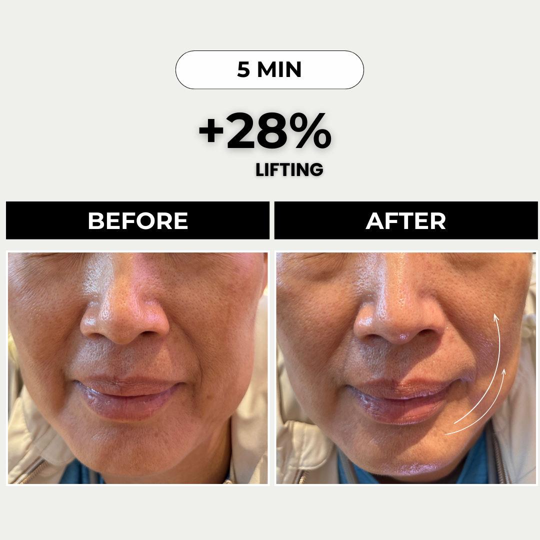 PDP Testimonial (Lifting)