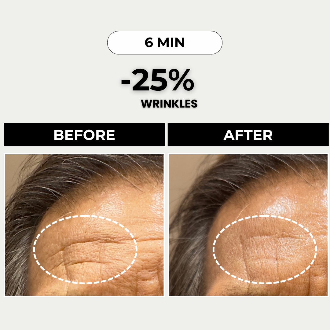 PDP Testimonial (Wrinkles)